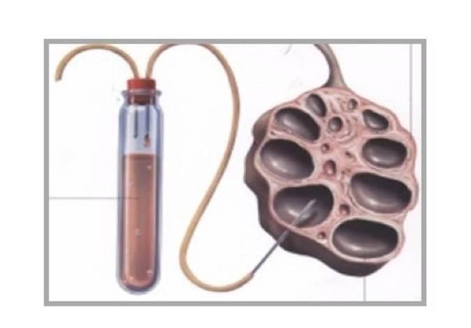 Follicle draining